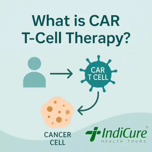 What is CAR T-Cell Therapy